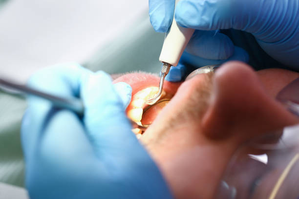 Best Emergency Dental Extractions in Robbins, IL