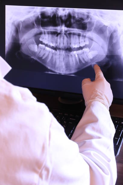 Best Emergency Dentist for Lost Fillings or Crowns in Robbins, IL