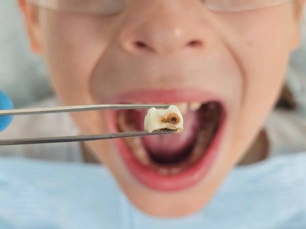 Best Orthodontic Emergency Dentist in Robbins, IL